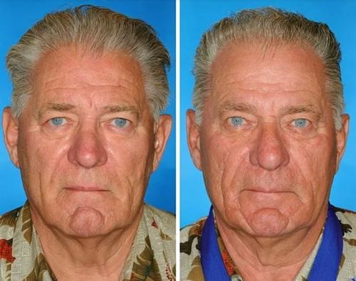 Сестры близнецы одна курит уже 16 лет другая не курила никогда. Как выглядят сестры и братья-близнецы, один из которых курит, а другой — нет 01