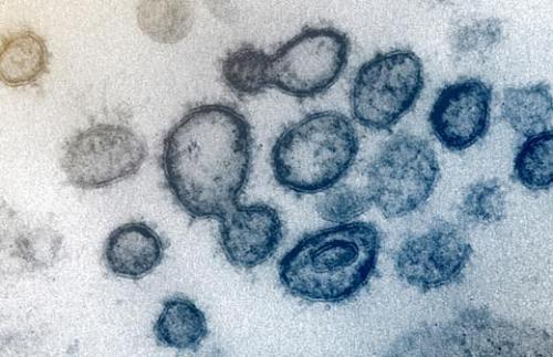 Китай испытывает от коронавируса лекарство из России. В Китай отгрузили 90 килограммов российского препарата против коронавируса 04
