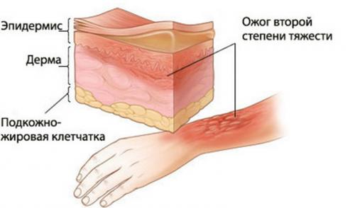 Самые сильные боли существующие в природе. 