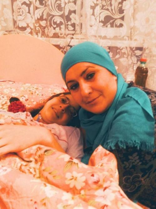 Сиамские близнецы животные. Ископаемая двухголовая ящерица 11