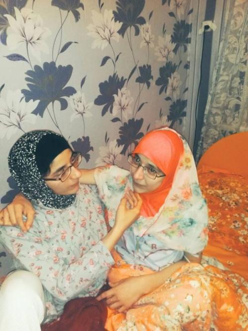 Сиамские близнецы животные. Ископаемая двухголовая ящерица 09