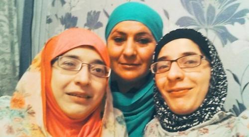 Сиамские близнецы животные. Ископаемая двухголовая ящерица 08