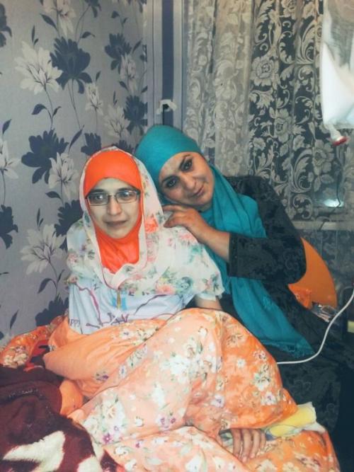 Сиамские близнецы животные. Ископаемая двухголовая ящерица 10