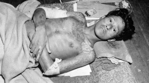 Хиросима и Нагасаки последствия. «Толстяк» в Нагасаки