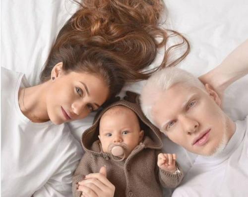 Бера иванишвили инстаграм. На кого похож годовалый сын единственного в мире музыканта-альбиноса, сына грузинского миллиардера