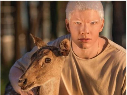 Бера иванишвили инстаграм. На кого похож годовалый сын единственного в мире музыканта-альбиноса, сына грузинского миллиардера