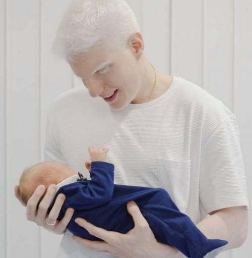 Бера иванишвили инстаграм. На кого похож годовалый сын единственного в мире музыканта-альбиноса, сына грузинского миллиардера