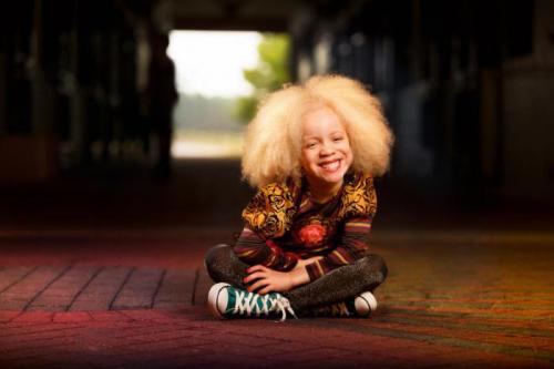 Альбинос негр модель: история и культура 11