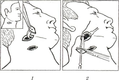 Атавизмы у животных. Примеры атавизмов у человека с фото, атавизмы у животных