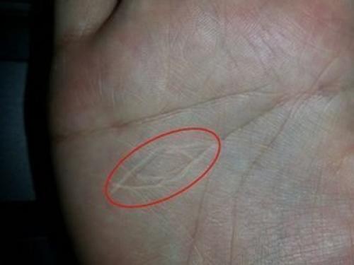 Ведьмины знаки на руке шестого пальца: что это и как их распознать 02