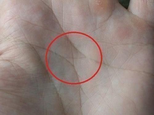 Ведьмины знаки на руке шестого пальца: что это и как их распознать 03