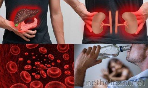 Открытие века: врач нашел эффективное лекарство от коронавируса 02