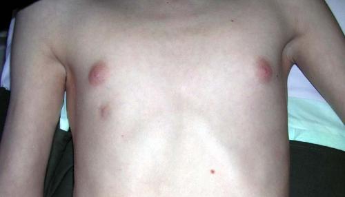 Атавизмы примеры. Примеры атавизмов у человека с фото, атавизмы у животных