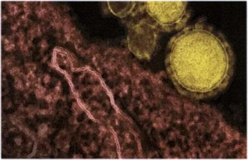Как россиянам защитить себя и близких от коронавируса? ПЯТЬ ПРАВИЛ ЗАЩИТЫ ОТ КОРОНАВИРУСА И ОРВИ 02