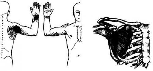 Точки на теле человека. Триггерные точки плеча и руки 08