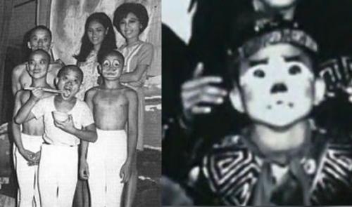 Джеки Чан здоровье. 02