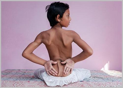 Что такое атавизм у животных. Примеры атавизмов у человека с фото, атавизмы у животных