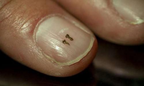 Почему некоторые животные имеют когти, которые могут вырасти до внушительных размеров. Переход от когтей к ногтям у приматов оказался сложнее, чем думали ранее