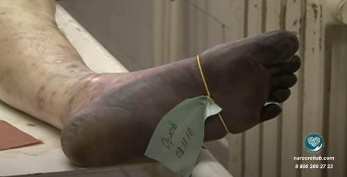 Бутиратный, что это значит. Бутират натрия