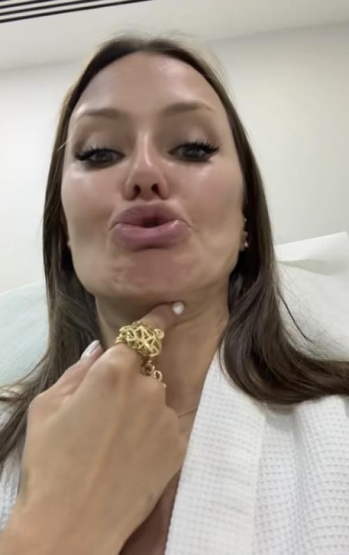 Боня снова живёт на максималках: говорит, жёстко отметили, текилу пила, а потом решила быстро привести лицо в порядок и поехала на ботокс. 01