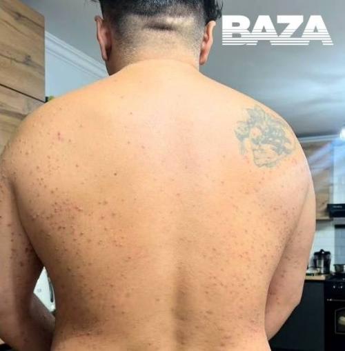 Турист заразился серьёзной инфекцией во время обряда очищения в священном источнике на Бали. 01 Турист заразился серьёзной инфекцией во время обряда очищения в священном источнике на Бали. 01