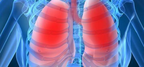 От пневмонии ежегодно умирает 4, 5 млн человек в расцвете сил - в основном это те, кому Некогда Болеть. 01