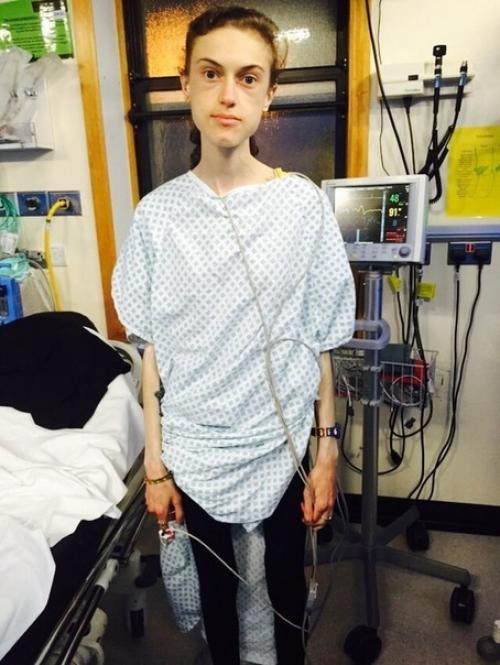 Эта сильная духом красавица поборола анорексию и добилась шикарных результатов! 03