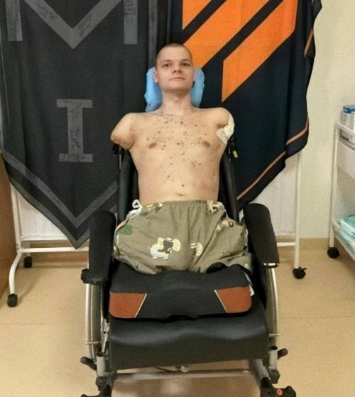 Боец всу с под корень ампутированными руками и ногами не смог пройти верификацию в банке, потому что не смог сфоткаться с картой в руке.