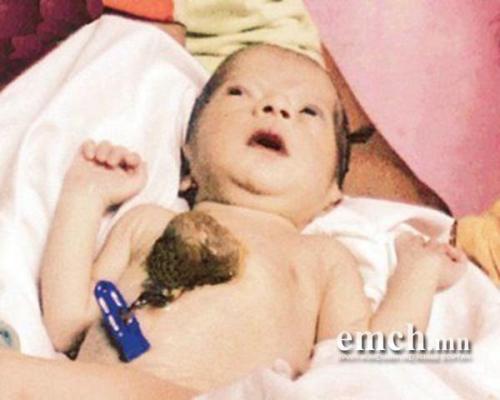 Рекорд по выживанию с Внешним Сердцем.