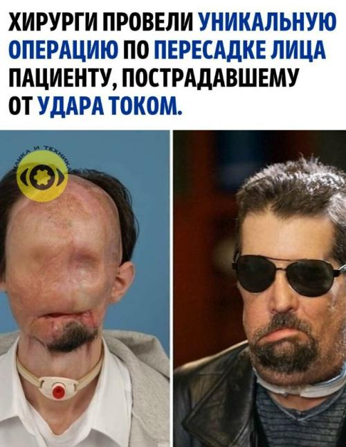 В марте 2011 года в бостонской больнице BWH команда под руководством доктора медицины Богдана помагача выполнила сложную реконструктивную операцию.  