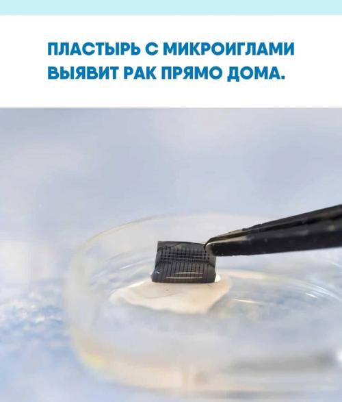 Американские учёные создали пластырь с микроиглами, позволяющий определять меланому - наиболее опасную форму рака кожи - прямо у себя дома.