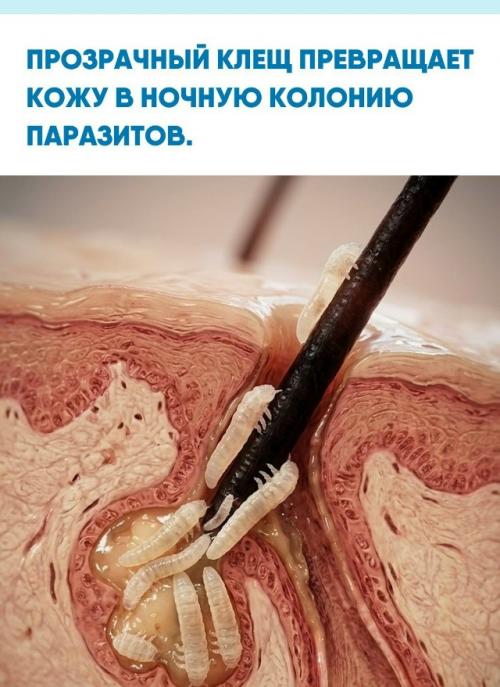Демодекс размером около 0, 3 мм живёт в сальных железах, питается кожным салом и активнее размножается ночью.  