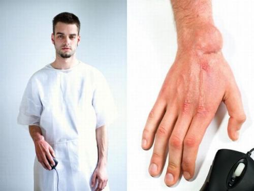 Травмы геймеров.  Перед вами люди, которые помешались на видео играх. 05