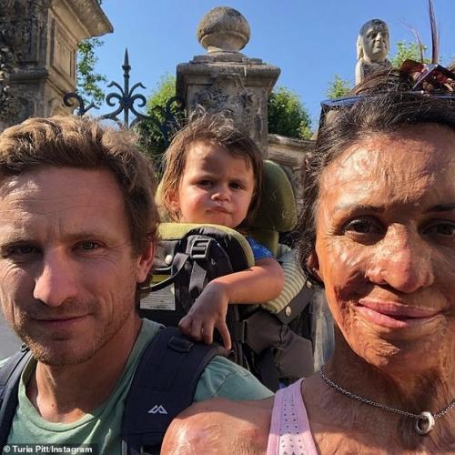 Эта 33-летняя австралийская модель попала в беду - из-за пожара у нее обгорело 70% тела. 06