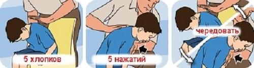 Что делать если ребенок подавился! 01