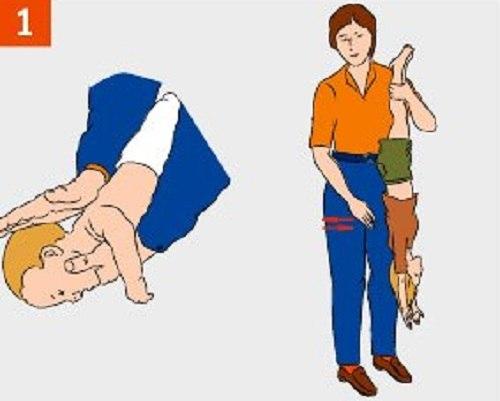 Что делать если ребенок подавился! 02