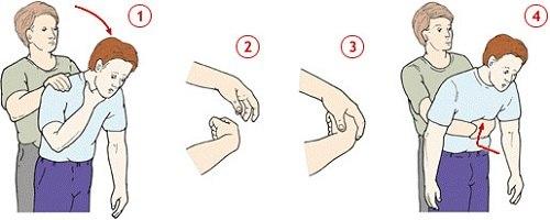 Что делать если ребенок подавился! 05