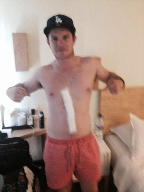 Паук туннель под кожей парня прорыл. 04