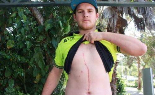 Паук туннель под кожей парня прорыл.