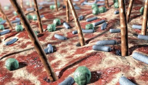 Невероятные изображения чужеродных форм жизни в организме человека.