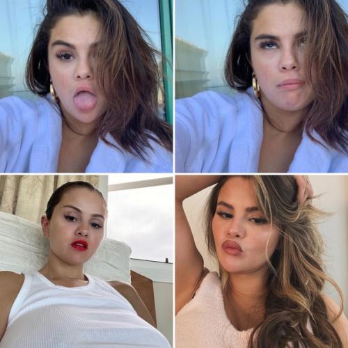 Сeлена гомес страдает от редкой аутоиммунной болeзни. 01 Сeлена гомес страдает от редкой аутоиммунной болeзни. 01