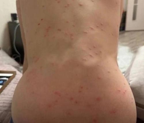 Церкарии атакуют российских туристов! 01