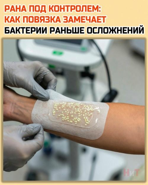 Обычная повязка просто закрывает рану, а новая разработка Brown University ведёт себя почти как химический сторож. 

