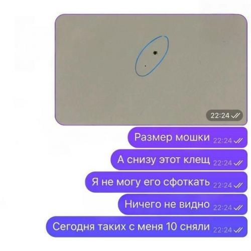 В России появились так называемые Наноклещи - миниатюрные паразиты размером всего 1-2 мм, которые уже атакуют людей. 02