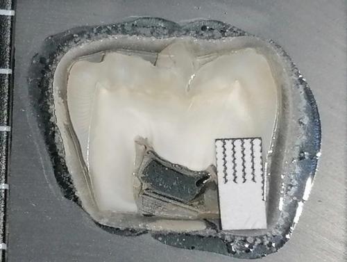 В России разработано тонкоплёночное зубное покрытие, которое имитирует природную эмаль и эффективно защищает от кариеса. 01