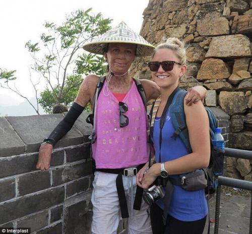 История любви Турии питт и Майкла хоскинса - вместе всем бедам вопреки. 08