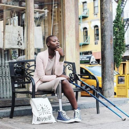 Девушке с ампутированной ногой оставалось жить всего 3 недели, но она победила болезнь и стала модным блогером.