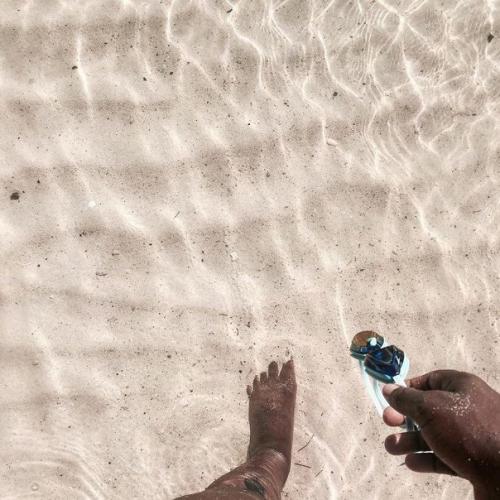 Девушке с ампутированной ногой оставалось жить всего 3 недели, но она победила болезнь и стала модным блогером. 04