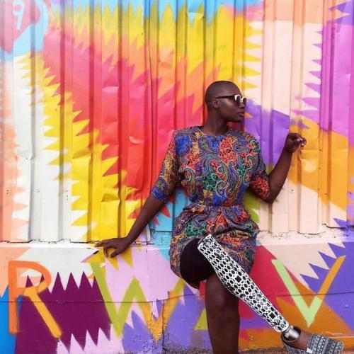 Девушке с ампутированной ногой оставалось жить всего 3 недели, но она победила болезнь и стала модным блогером. 03