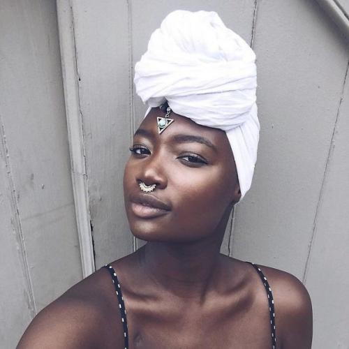 Девушке с ампутированной ногой оставалось жить всего 3 недели, но она победила болезнь и стала модным блогером. 05